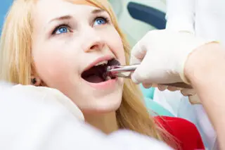 tooth extraction Houston