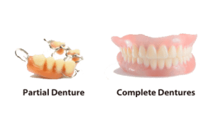 Image of Dentures and Partial Dentures