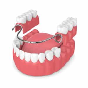 Image showing Partial Dentures